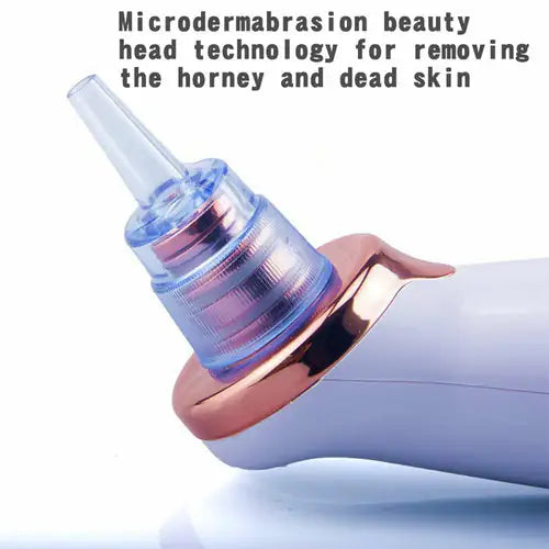 Removedor de Puntos Negros Eléctrico – Aspirador Facial para Limpieza Profunda de Poros